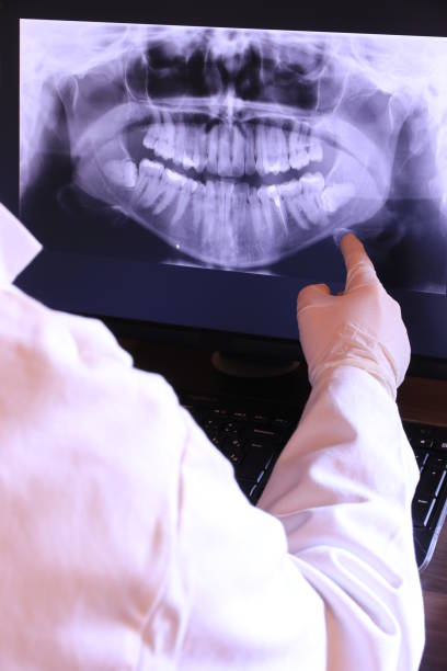 Best Emergency Dentist for Knocked-Out Tooth in Charter Oak, CA