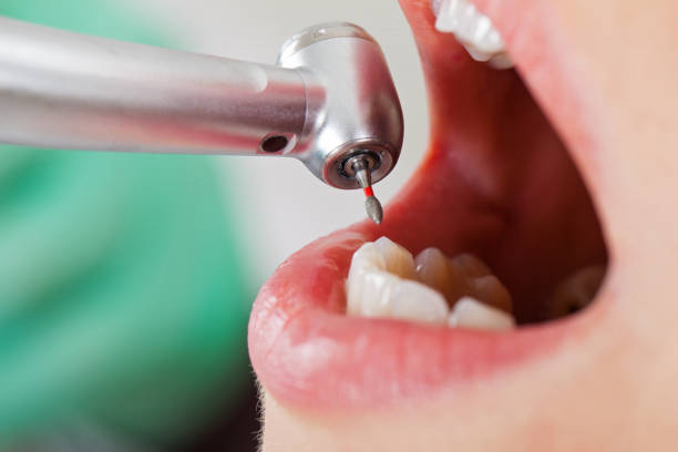 Best Emergency Dental Services for Seniors in Charter Oak, CA